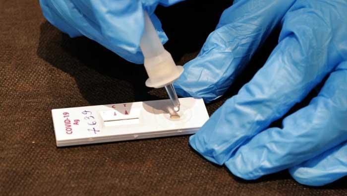 Znakovi da ste možda već imali koronu | Domoljubni portal CM | Zdravlje